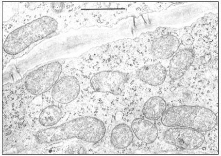 plant cell mitochondria microscope